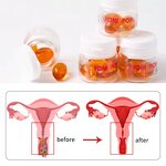 Vaginal Tightening Gel - Hot Selling Feminine Care Plant Extract Safety Pleasure