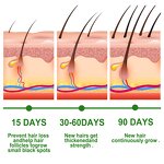 Rosemary Hair Oil - Dense Hair Growth Loss Prevention Anti-Hair Loss Treatment