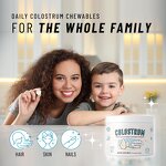 Bovine Colostrum Chewable Tablets Manufacturer - 50% IgG for Gut Health