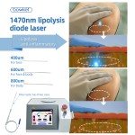 1470nm Laser Manufacturer - Bowket Machine for Weight Loss Skin Tightening Wrinkle Removal Home Use