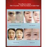 Portable RF Machine Manufacturer - High Frequency 5MHz Radio Frequency Wrinkle Removal Face Lift EU