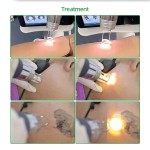 ND YAG Laser Factory - 2023 Tattoo Removal Beauty 1200W Power New Design for Spa Clinic