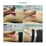 3D Body Shaper Factory - BOWKET Bio Vacuum Therapy Back Massager 80k Cavitation Machine Rf