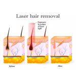 Diode Laser Machine Factory - Portable 3 Wavelength with Skin Cooling Whitening Electric System