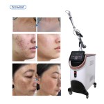 Pico Laser Machine Manufacturer - Bowket Tattoo Pigmentation Removal Dark Spot Freckle Treatment