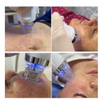 Facial Tightening Machine Factory - Fractional Radiofrequency Beauty Equipment for Body