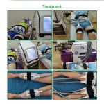 Body Sculpting System Factory - Hot Massage Waist Reduction Chin Removal Cryo Facial Arm Leg