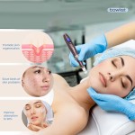 Micro Needling Pen Factory - BOWKET Professional Electric Wireless Derma Pen Home Use Rechargeable