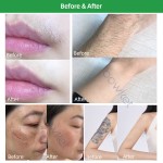 多功能激光生产商-便携ND YAG二极管皮秒纹身脱毛机