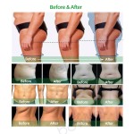 Body Sculpting System Factory - Hot Massage Waist Reduction Chin Removal Cryo Facial Arm Leg