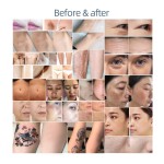 IPL Hair Removal Manufacturer - BOWKET Multifunctional 2 Handles User-Friendly Painless Breast Massager