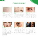 Picosecond Laser Manufacturer - BOWKET Portable 755nm 530nm 1064nm Tattoo Removal Beauty