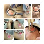 CO2 Laser Machine Manufacturer - BOWKET 30W RF Tube Fractional for Breast Skin Rejuvenation