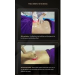 身体按摩器生产商-DDS磁疗面部按摩器80千便携空化