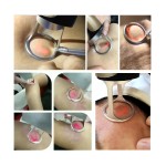 Skin Rejuvenation Laser Factory - Bowket Vaginal Tightening CO2 60W Fractional Laser Machine