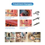 ND-YAG Laser Manufacturer - Portable Scar Tattoo Removal Home Use Skin Tightening Hair Removal