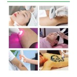 Medical Hair Removal Factory - Bowket Fast-Painless Permanent Diode Laser for Body Face Breast