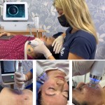 RF Skin Lifting Factory - Device with Microneedle Wrinkle Remover Skin Rejuvenation Firming Tightening