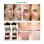 3D Body Shaper Factory - BOWKET Bio Vacuum Therapy Back Massager 80k Cavitation Machine Rf