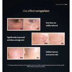 Skin Rejuvenation Device Manufacturer - Portable Electric Anti-Wrinkle Handheld Red Infrared Light Therapy