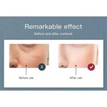 LED Light Therapy Device Manufacturer - Professional 7-Color with Cold Sprayer Mist Hydrating