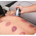 Body Slimming Instrument Manufacturer - Pain-Free Negative Pressure Heating Electric Cupping Scraping