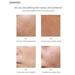 Meso Injector Gun Manufacturer - Professional Electric for Face Body Stainless Steel Needle