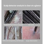 Skin Analyzer Camera Manufacturer - Wireless WiFi Scalp Hair Scanner Compatible with Android & iOS