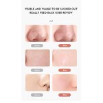 Blackhead Remover Manufacturer - LED Visible Camera Hot Cold Compress Vacuum for Acne Pore