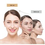 RF Beauty Instrument Manufacturer - Nutrition Introduction Collagen LED DOT Matrix for Wrinkle Removal