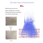 Derma Pen Needles Manufacturer - Professional with LED Light Cartridge for Micro Needling