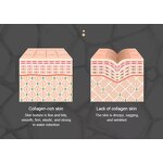 RF Beauty Instrument Manufacturer - Nutrition Introduction Collagen LED DOT Matrix for Wrinkle Removal