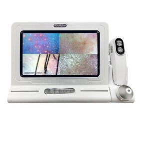 Skin Analyzer Manufacturer - 3D 11 Inch Screen Hair Diagnosis Four-Spectral UV Light