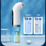 Facial Kit Manufacturer - Women's Electric Small Bubble Vacuum for Blackhead Acne Pore Cleaner