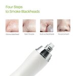 Microdermabrasion Machine Manufacturer - SC-180 Professional Portable Diamond Peel Big Suction