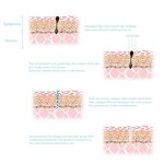 Plasma Pen Manufacturer - Professional Multifunctional for Eye Lift & Acne Treatment ABS