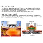 7-in-1 Cavit Machine - 2025 OEM ODM 80K 40K Vacuum Weight Loss Tool