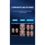 Skin Analysis Equipment - Facial Type Testing Salon Beauty Center Tool