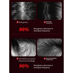 Scalp Massage Brush Manufacturer - Red Blue Light Therapy Vibrating Oil Spray Hair Growth