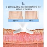 Face and Neck Massager Manufacturer - Ems Four-Color Light Anti-Wrinkle Youthproof Factory Direct