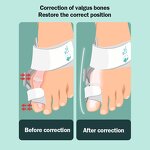 Thumb Orthosis Splint - Adjustable Support Hallux Valgus Corrector Thumb Brace