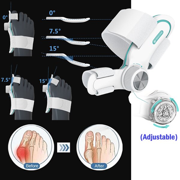 Hallux Valgus Bunion Splint - Tenicore 129° Rotate 3 Fixing Plates Walking Tool