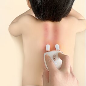 Nasal Meridian Massager - OEM Acupoint Push Facial Scraping Children Back Tool