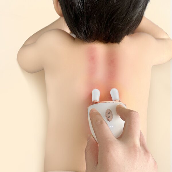 Nasal Meridian Massager - OEM Acupoint Push Facial Scraping Children Back Tool