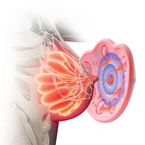 Custom Mouth Guard - Wholesale Sports Football Basketball Gum Shield Tooth Guard