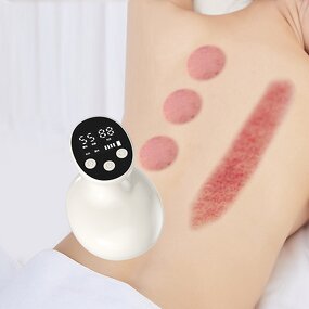 Electric Scraping Tool - Handheld High Suction Cupping Bloodletting Body Therapy