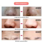 LED Light Therapy Mask Manufacturer - Wholesale Portable 7-Colorful USB Powered Multi-Function