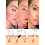 Facial Massager - Hot Selling Home Use Face Lifting Beauty Equipment