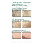 Rechargeable IPL Hair Remover - Painless Flash Laser Facial Body Tool