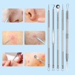 Blackhead Remover Kit Supplier - 8pcs Acne Extraction Tool Set